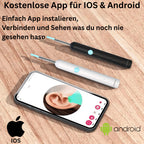 ⏳Begrenzte Zeit 50% Rabatt💥Intelligenter wasserdichter visueller Ohrenschmalzentferner