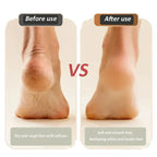 2025 Neues USB-Ladegerät für Fußreparaturen und Schleifen