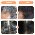 🔥🥰Haarfärbemittel mit Pflanzenextrakten für graues Haar